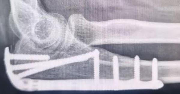 一分钟了解“链接炸 金花怎么买房卡”详细房卡教程