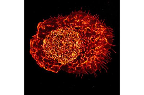 严重的COVID-19可能导致长期的先天免疫系统变化