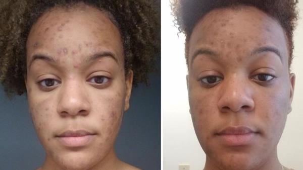 1分钟了解!微信拼三张透视挂-链接找谁买- 1分钟了解!微信拼三张透视挂-链接找谁买-